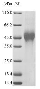 Human VSIG1 Protein (Recombinant 10His, N-terminus)