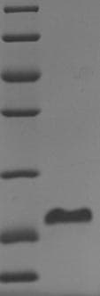 Human Coagulation Factor VII Protein (Recombinant 6His, N-terminus)