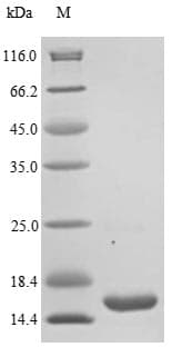 Staphylococcus aureus scn Protein (Recombinant 10His, N-terminus)
