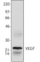 Polyclonal Rabbit anti-Human VEGFA / VEGF Antibody (clone Poly6275, WB)