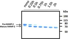 Human MMP2 Protein (Recombinant)