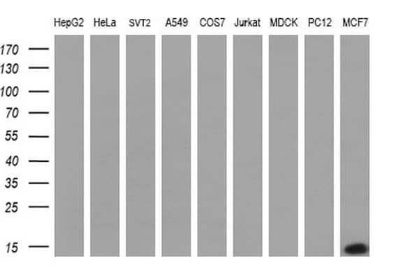 S100A9 / MRP14 Antibody (clone OTI2A2, Carrier-free)