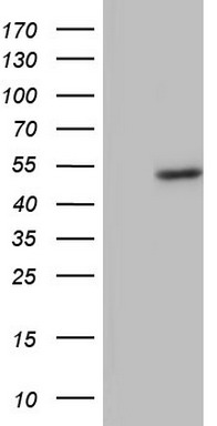 BFSP2 Antibody (aa184-415, clone OTI4E7, Carrier-free)
