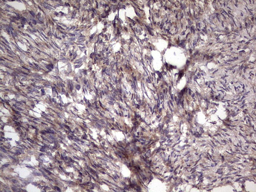 BFSP2 Antibody (aa184-415, clone OTI4E7, Carrier-free)