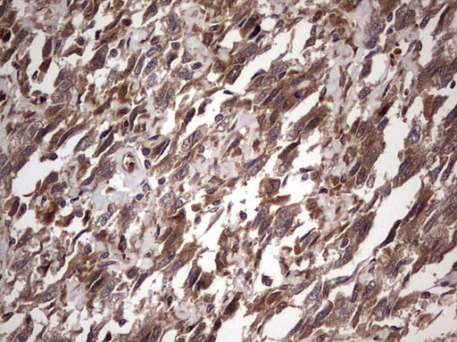 BFSP2 Antibody (aa184-415, clone OTI4E7, Carrier-free)