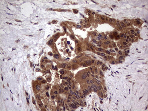 BFSP2 Antibody (aa184-415, clone OTI4E7, Carrier-free)