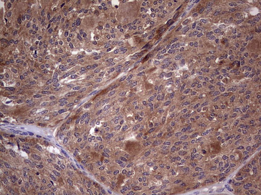 BFSP2 Antibody (aa184-415, clone OTI4E7, Carrier-free)