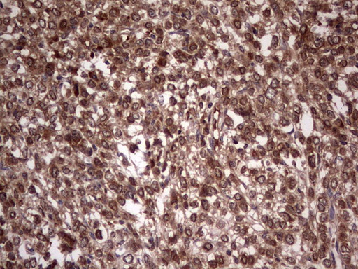 BFSP2 Antibody (aa184-415, clone OTI4E7, Carrier-free)