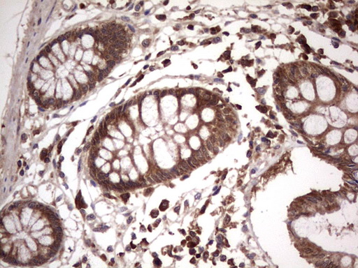 BFSP2 Antibody (aa184-415, clone OTI4E7, Carrier-free)