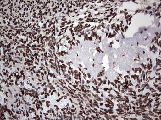 PARP1 Antibody (clone 5F1, Carrier-free)