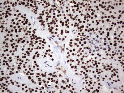 PARP1 Antibody (clone 5F1, Carrier-free)