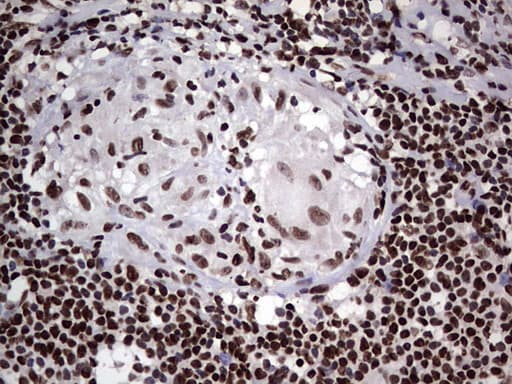 PARP1 Antibody (clone 5F1, Carrier-free)