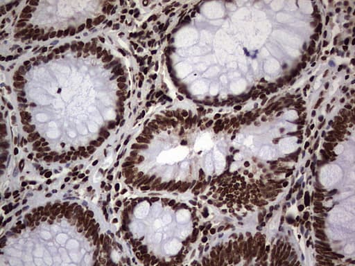 PARP1 Antibody (clone 5F1, Carrier-free)