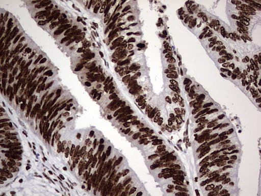 PARP1 Antibody (clone 5F1, Carrier-free)