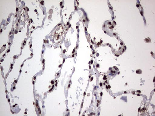 PARP1 Antibody (clone 5F1, Carrier-free)