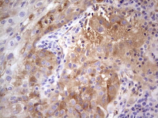 Monoclonal Mouse anti-Human CFI / Complement Factor I Antibody (clone OTI15H9, Carrier-free, aa340-583, IHC, WB)