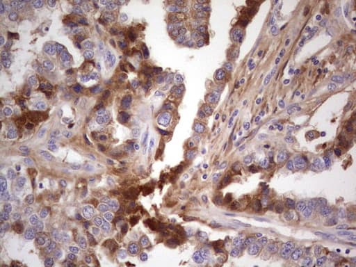 Monoclonal Mouse anti-Human CFI / Complement Factor I Antibody (clone OTI15H9, Carrier-free, aa340-583, IHC, WB)