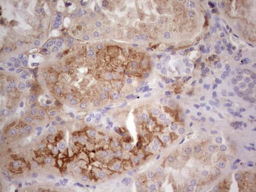 Monoclonal Mouse anti-Human CFI / Complement Factor I Antibody (clone OTI15H9, Carrier-free, aa340-583, IHC, WB)