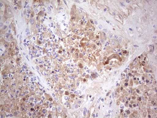 Monoclonal Mouse anti-Human CFI / Complement Factor I Antibody (clone OTI17F1, Carrier-free, aa340-583, IHC, WB)