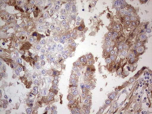 Monoclonal Mouse anti-Human CFI / Complement Factor I Antibody (clone OTI17F1, Carrier-free, aa340-583, IHC, WB)