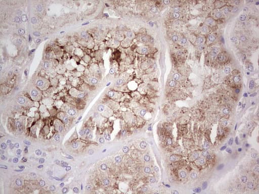 Monoclonal Mouse anti-Human CFI / Complement Factor I Antibody (clone OTI17F1, Carrier-free, aa340-583, IHC, WB)