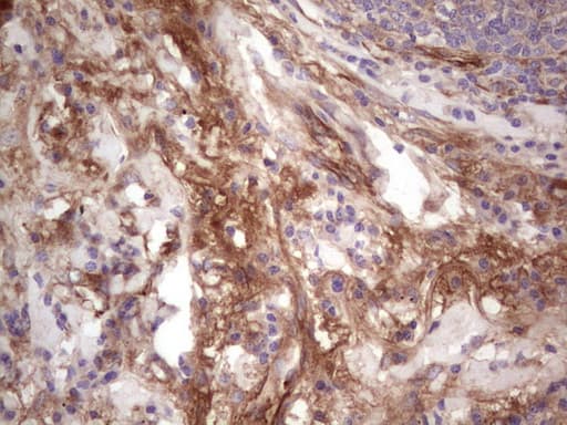 CFI / Complement Factor I Antibody (aa340-583, clone OTI4A8, Carrier-free)