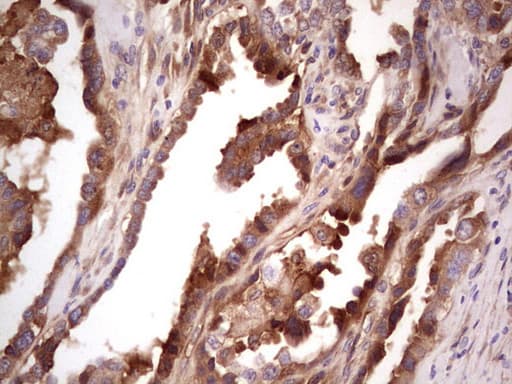 CFI / Complement Factor I Antibody (aa340-583, clone OTI4A8, Carrier-free)