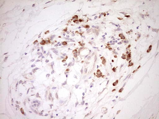 Monoclonal Mouse anti-Human NR0B2 Antibody (clone OTI5F10, Carrier-free, IHC, WB)