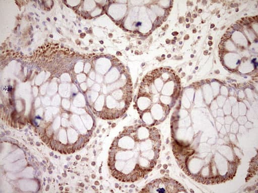 NR0B2 Antibody (clone OTI7B5, Carrier-free)