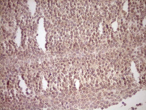 NR0B2 Antibody (clone OTI8E5, Carrier-free)