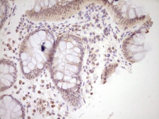 NR0B2 Antibody (clone OTI8E5, Carrier-free)