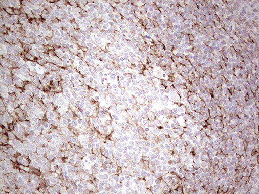 DMN / Desmuslin / Synemin Antibody (aa329-580, clone OTI3D10, Carrier-free)