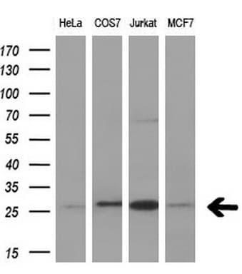 Monoclonal Mouse anti-Human BCL2 / Bcl-2 Antibody (clone OTI5F8, Carrier-free, IHC, WB)