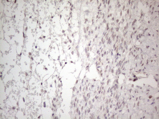 MMP2 Antibody (aa228-507, clone OTI4A11)