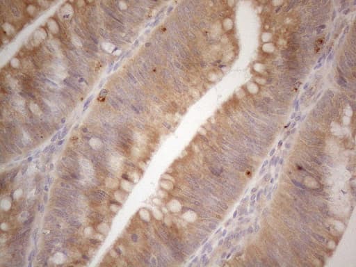 VIP Antibody (clone OTI2F3, Carrier-free)