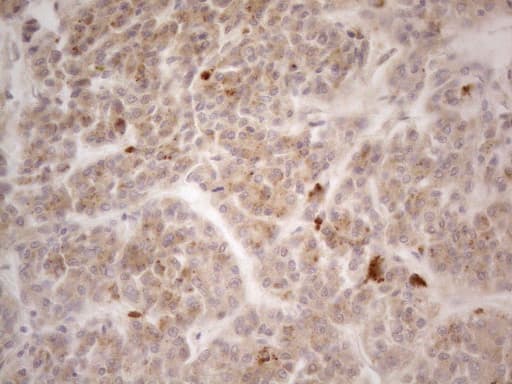 VIP Antibody (clone OTI5B5, Carrier-free)