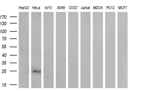 Monoclonal Mouse anti-Human CITED1 Antibody (clone OTI3C12, Carrier-free, IHC, WB)
