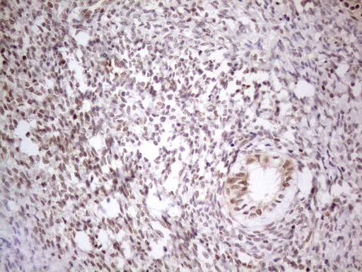 MED15 / ARC105 Antibody (aa393-679, clone OTI2C6)