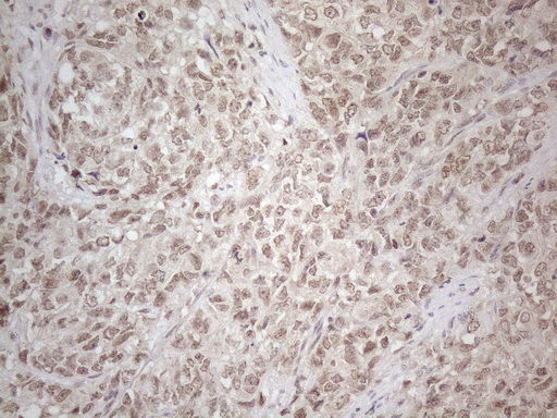 MED15 / ARC105 Antibody (aa393-679, clone OTI2C6)