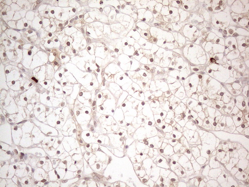 MED15 / ARC105 Antibody (aa393-679, clone OTI2C6)