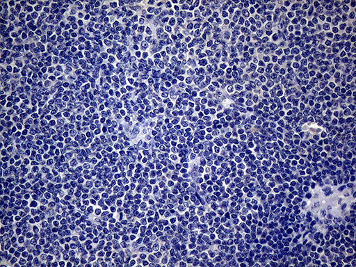 SP110 Antibody (aa232-521, clone OTI1H5)