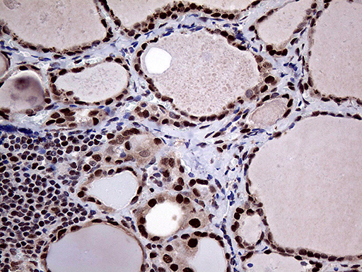 Monoclonal Mouse anti-Human PPP4C Antibody (clone OTI2E4, Carrier-free, IHC, WB)