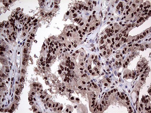 Monoclonal Mouse anti-Human PPP4C Antibody (clone OTI2E4, Carrier-free, IHC, WB)