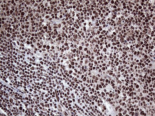 Monoclonal Mouse anti-Human PPP4C Antibody (clone OTI2E4, Carrier-free, IHC, WB)