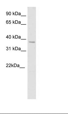 Polyclonal Rabbit anti-Mouse SPI1 / PU.1 Antibody (HRP, aa61-110, WB)