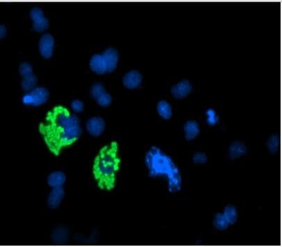 MYC / c-Myc Antibody (aa408-432)