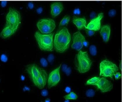 MYC / c-Myc Antibody (aa408-432)