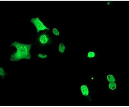 MYC / c-Myc Antibody (aa408-432)