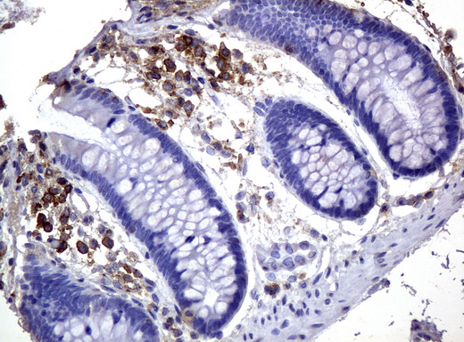 Monoclonal Mouse anti-Human CD3E Antibody (clone UMAB54, Carrier-free, IHC, IF, WB)
