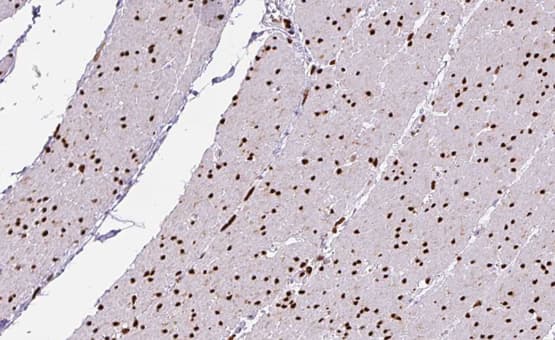 Polyclonal Rabbit anti-Human ILKAP Antibody (IHC, IF, WB)